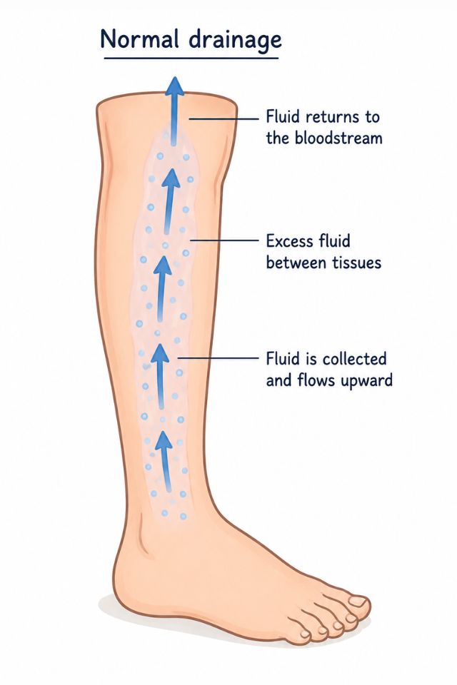 A clear, free-flowing drain — a healthy lymphatic system at work